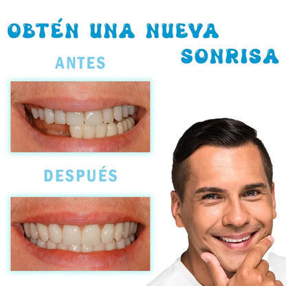 RESINA MOLDEABLE PARA DIENTES - PAGA 1 Y LLEVA 2